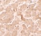 GBP5 Antibody